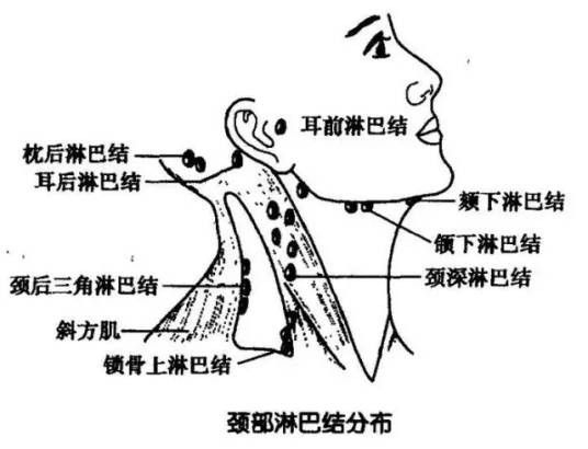 慢性颈淋巴结炎