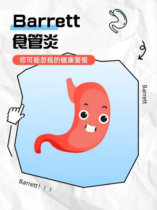 Barrett食管炎