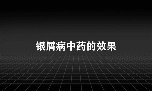 银屑病中药的效果