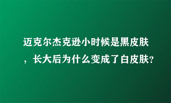 迈克尔杰克逊小时候是黑皮肤,长大后为什么变成了白皮肤?