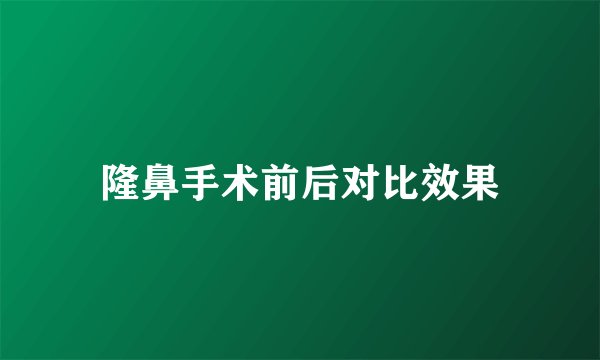 隆鼻手术前后对比效果