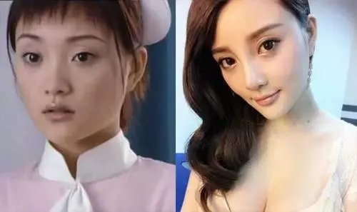 哪些女明星本来很好看却要整容,还越整越丑?