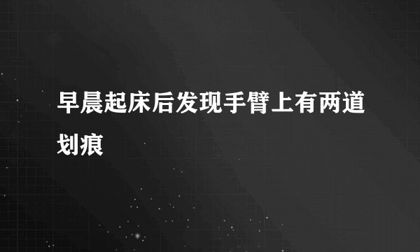 早晨起床后发现手臂上有两道划痕
