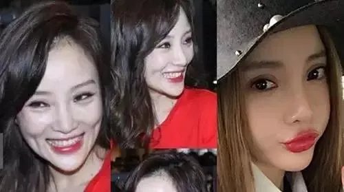 哪些女明星本来很好看却要整容,还越整越丑?