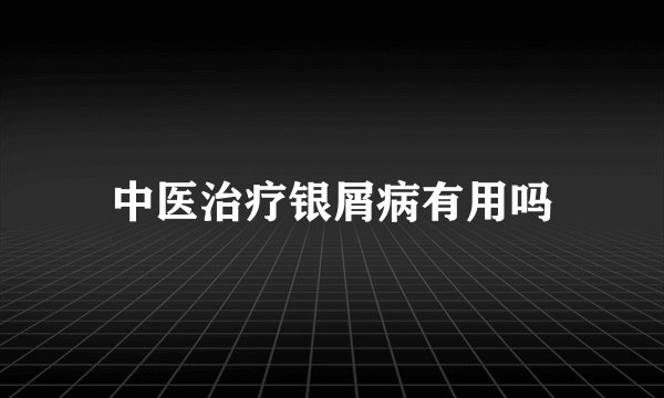 中医治疗银屑病有用吗