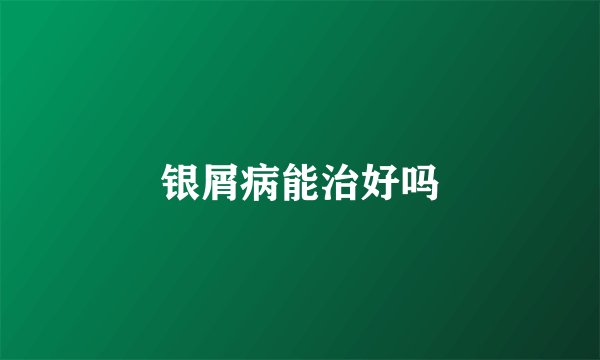 银屑病能治好吗