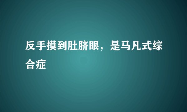反手摸到肚脐眼，是马凡式综合症
