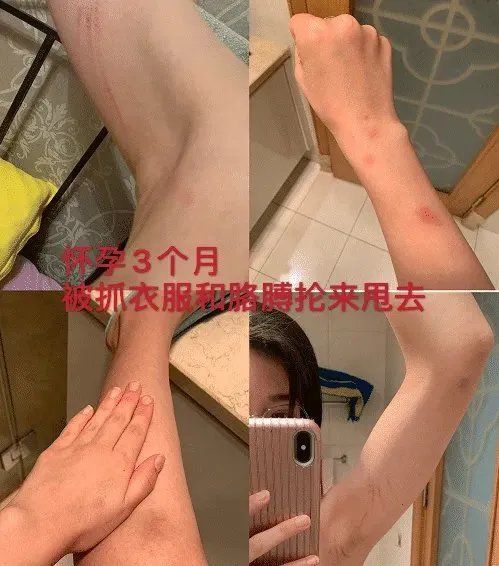 短跑名将婚内出轨,并多次实施家暴,是运动员都这样吗?
