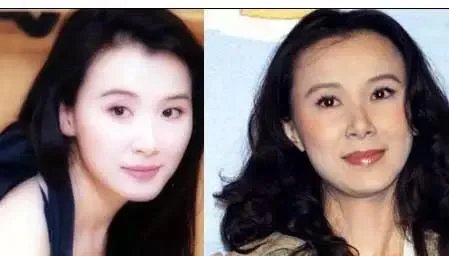 哪些女明星本来很好看却要整容,还越整越丑?