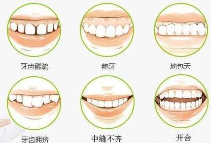牙科矫正牙齿