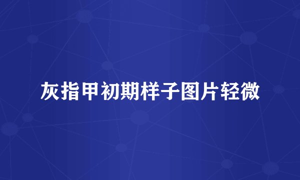 灰指甲初期样子图片轻微