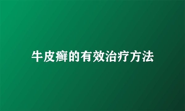 牛皮癣的有效治疗方法