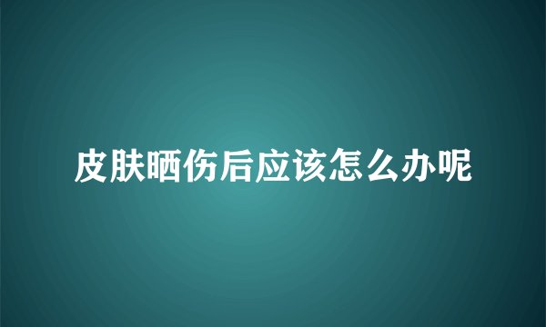皮肤晒伤后应该怎么办呢