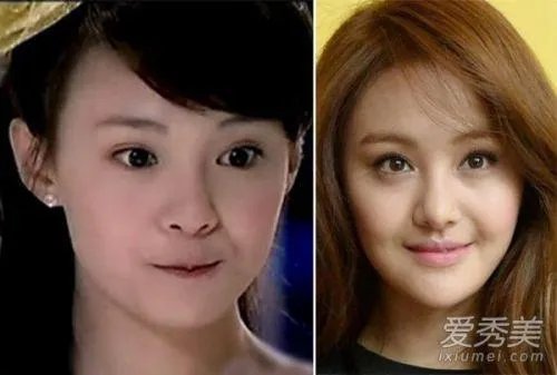 哪些女明星本来很好看却要整容,还越整越丑?