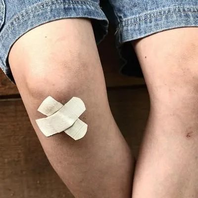 怎么治疗风湿性关节炎