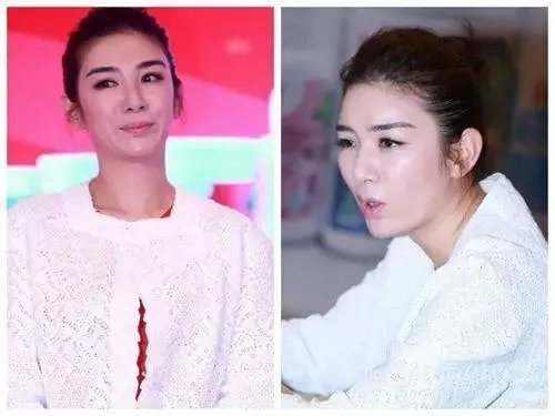 哪些女明星本来很好看却要整容,还越整越丑?
