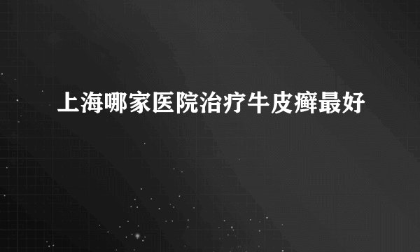 上海哪家医院治疗牛皮癣最好