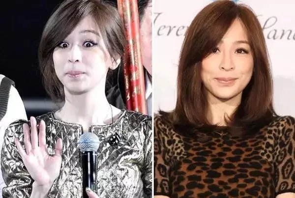 哪些女明星本来很好看却要整容,还越整越丑?