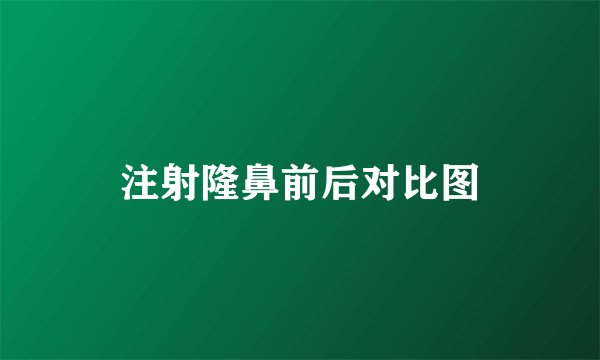 注射隆鼻前后对比图