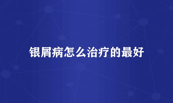 银屑病怎么治疗的最好