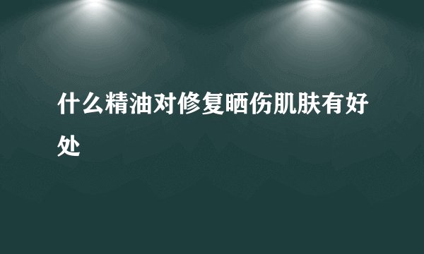 什么精油对修复晒伤肌肤有好处