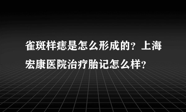 雀斑样痣是怎么形成的?上海宏康医院治疗胎记怎么样?