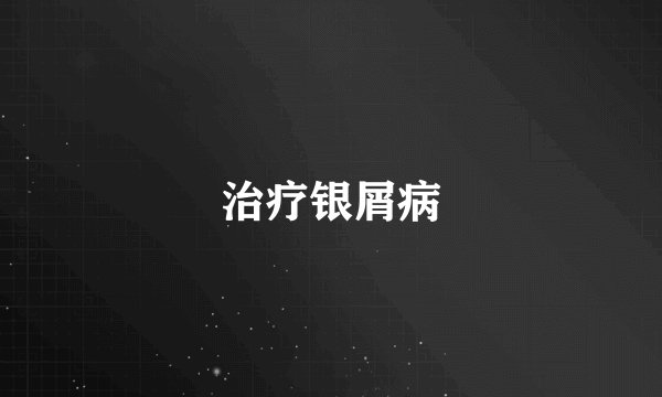 治疗银屑病