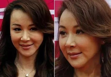 哪些女明星本来很好看却要整容,还越整越丑?