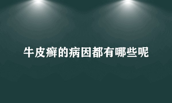 牛皮癣的病因都有哪些呢
