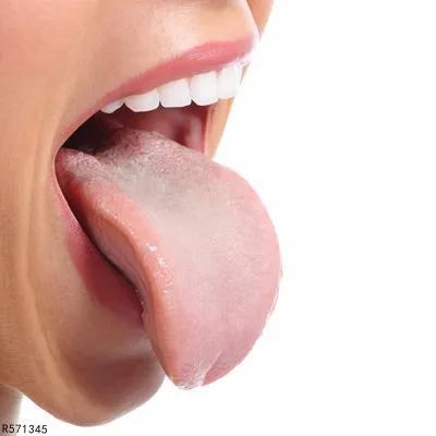 舌下腺囊肿手术后注意什么