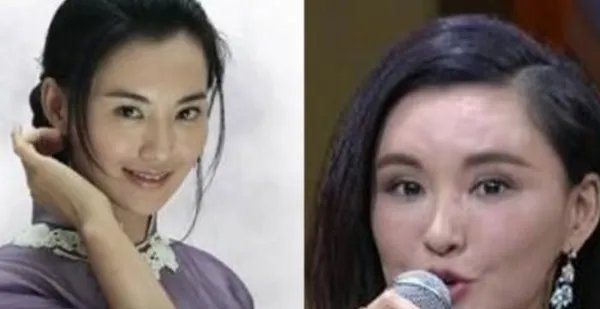 中国有没有整容失败的女明星?都有谁?