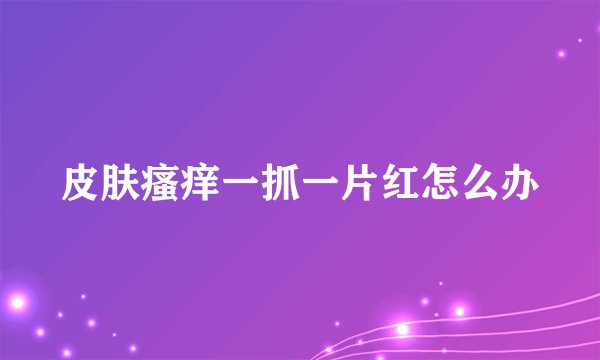 皮肤瘙痒一抓一片红怎么办