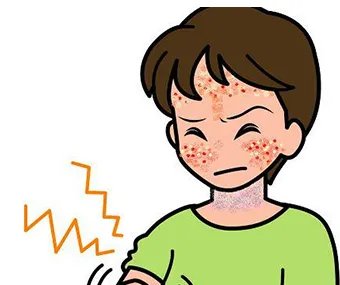 丘疹性皮炎