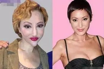 哪些女明星本来很好看却要整容,还越整越丑?