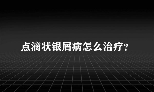 点滴状银屑病怎么治疗？
