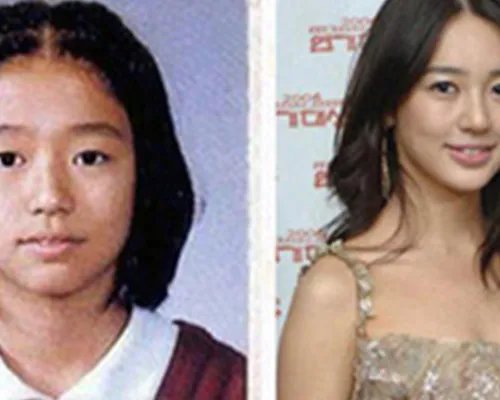 尹恩惠整容前后照片对比判若两人 鼻子成整容范本