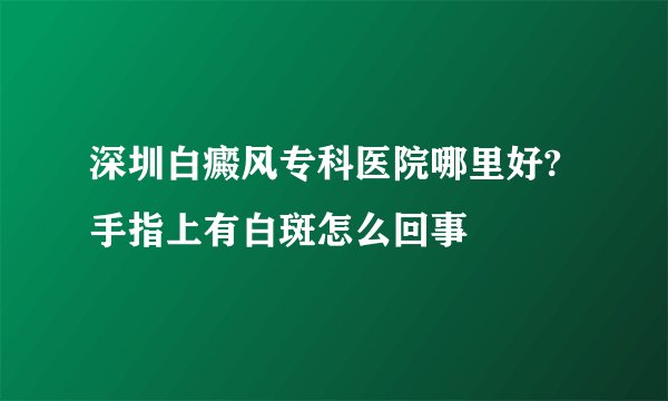 深圳白癜风专科医院哪里好?手指上有白斑怎么回事