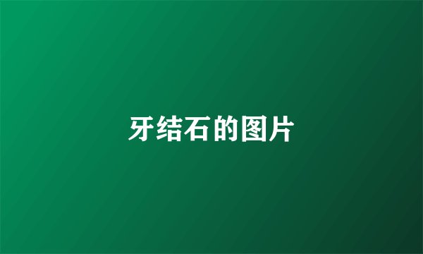 牙结石的图片