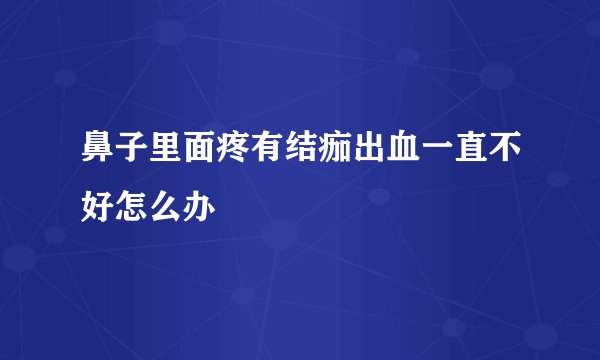 鼻子里面疼有结痂出血一直不好怎么办