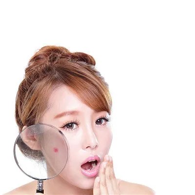 脸上长痤疮是什么原因