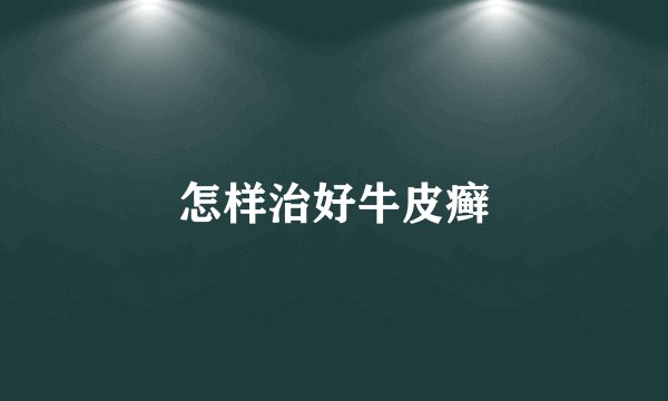 怎样治好牛皮癣