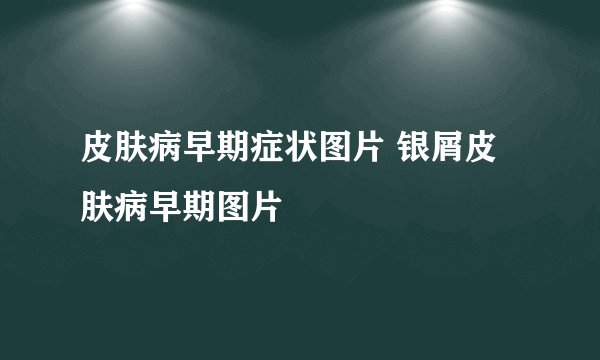 皮肤病早期症状图片 银屑皮肤病早期图片