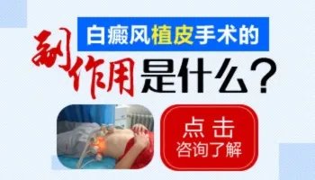 邯郸市远大白癜风医院有那么好吗