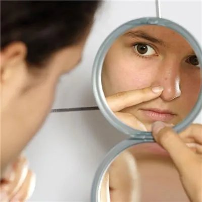 青春痘印怎么治疗
