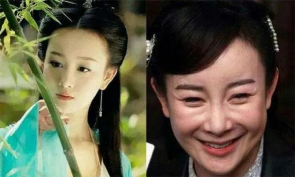 有哪些明星整容整的很失败的案例？