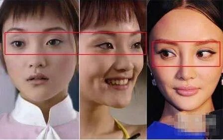 哪些女明星本来很好看却要整容,还越整越丑?