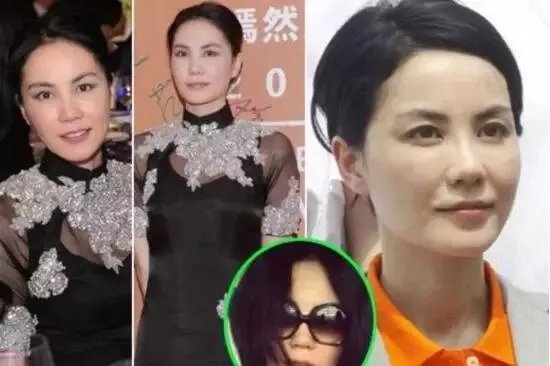 哪些女明星本来很好看却要整容,还越整越丑?
