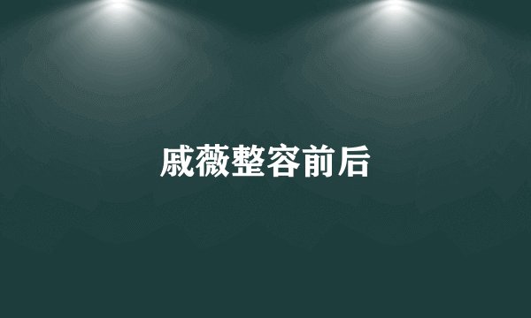 戚薇整容前后