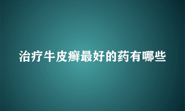 治疗牛皮癣最好的药有哪些