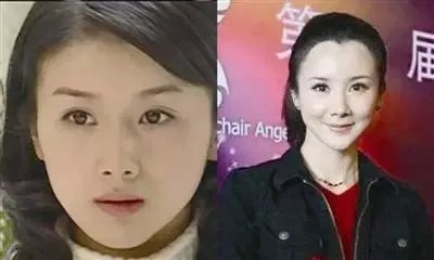 哪些女明星本来很好看却要整容,还越整越丑?